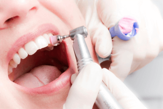 Польза профессиональной чистки зубов