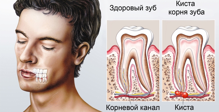 Причины возникновения