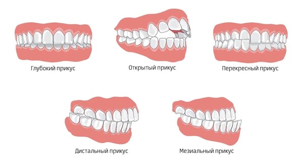 рисунок