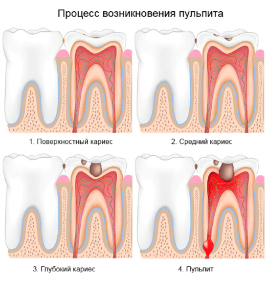 Симптомы