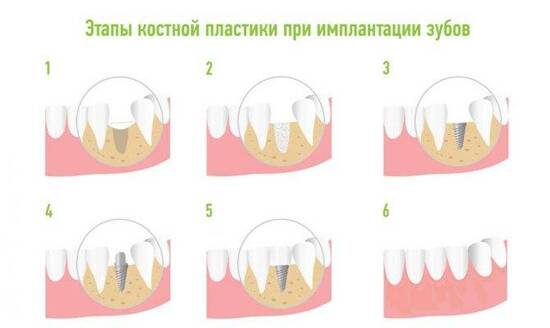 Используемые методы 