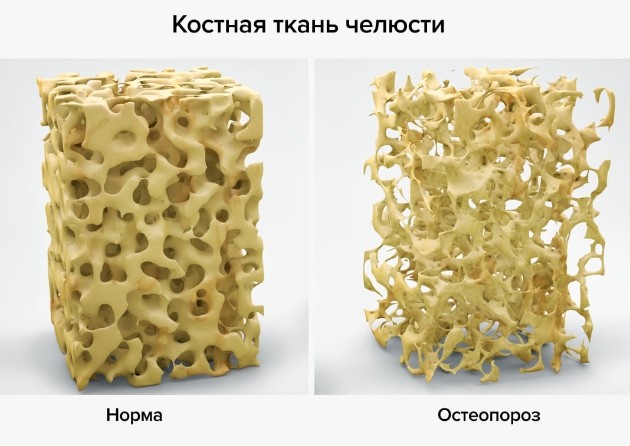 Возможно ли имплантация зубов без костной пластики?