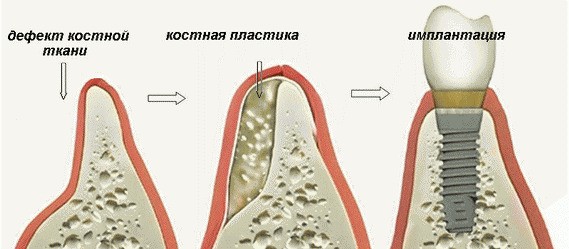 Возможно