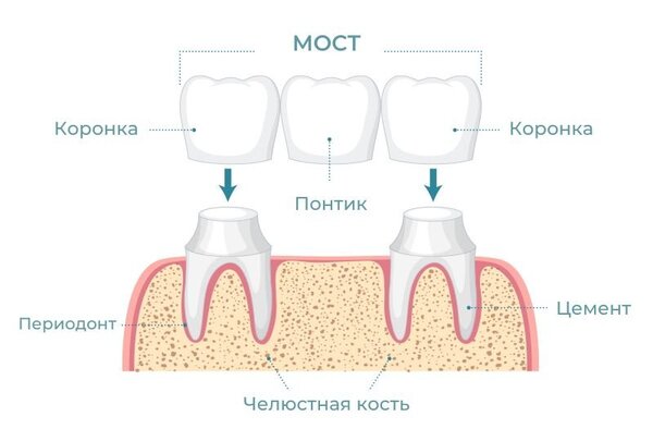 Мост