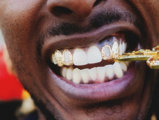 Украшения для зубов: виды, показания и противопоказания