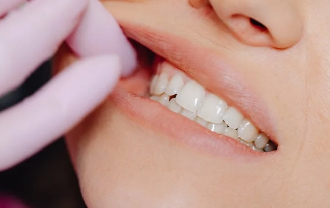 Безопасное отбеливание зубов: способы и методы проведения