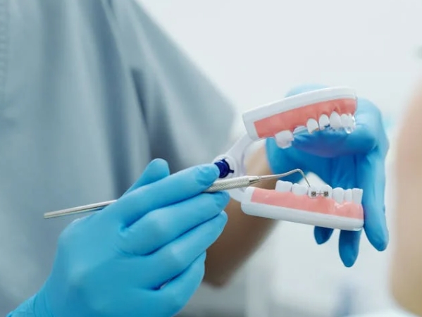 Что такое шинирование зубов? Показания и виды.