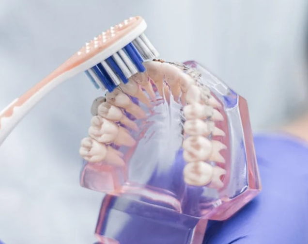 Самые распространенные проблемы с зубами