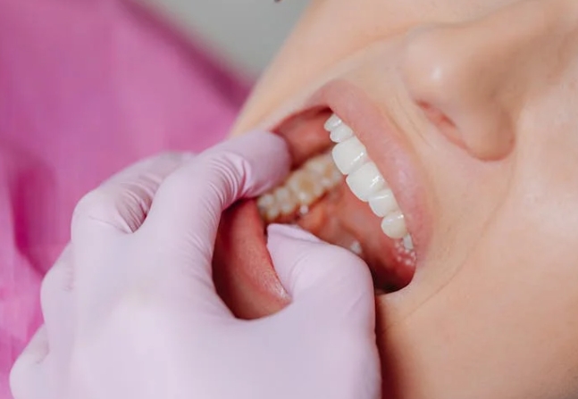 Пластика мягких тканей вокруг имплантата.