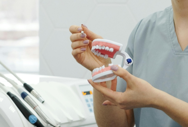 Как отличить качественный зубной имплант от некачественного?