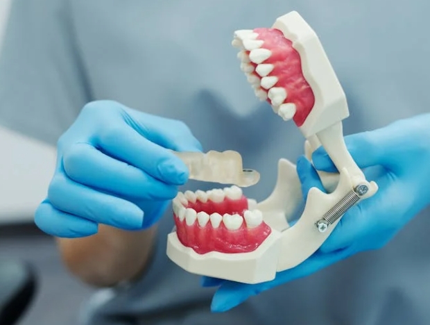 Как часто следует менять зубные протезы?