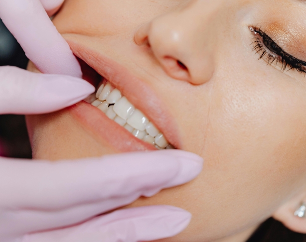 Наращивание костной ткани при имплантации.