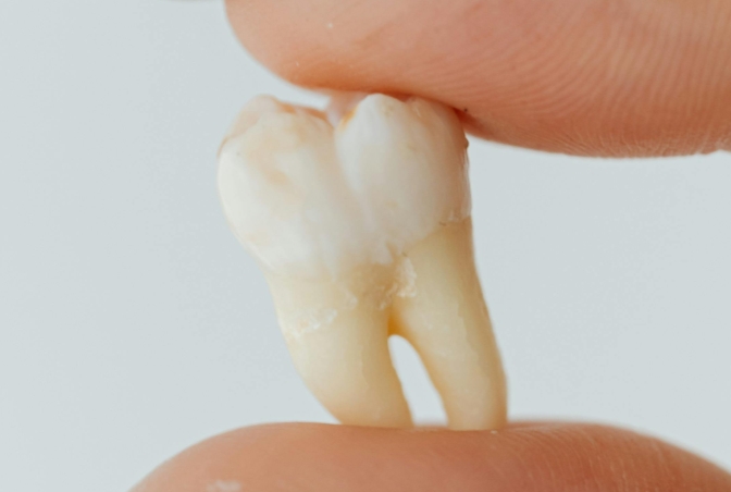 Может ли болеть зуб без нерва?