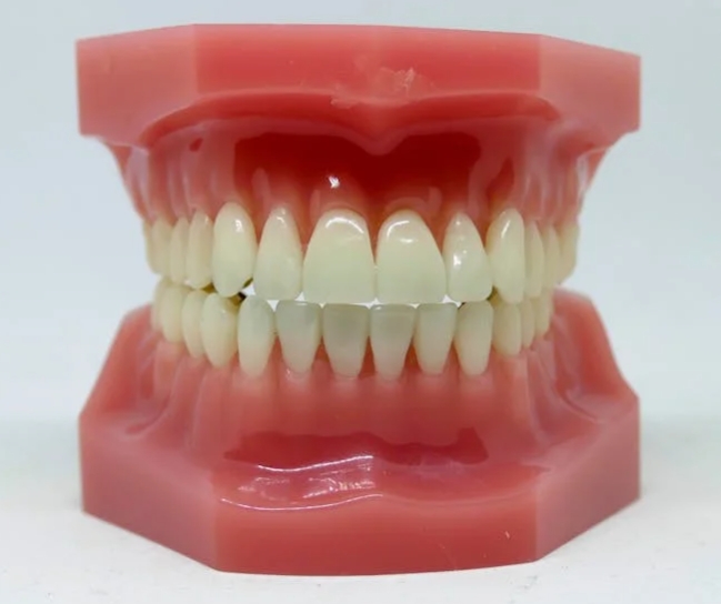 Воспаление десны под протезом