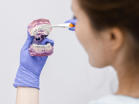 Правила питания при ношении брекетов