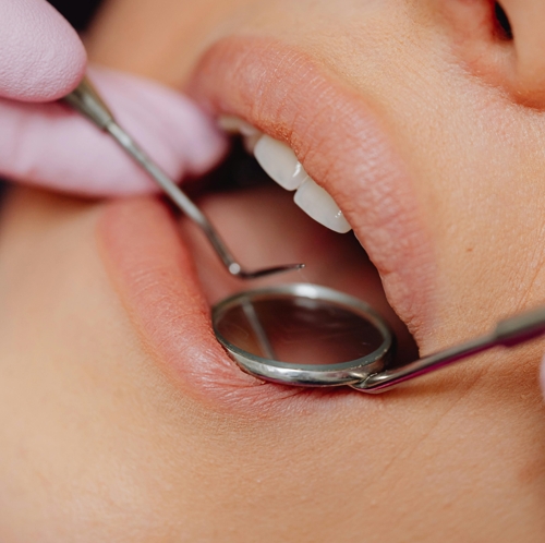 Повышенная чувствительность зубов: причины и лечение