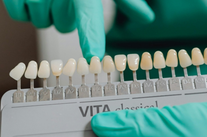 Как сохранить результат после отбеливания зубов?