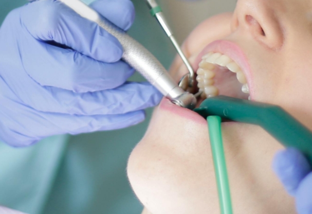 Что делать, если почернел зуб под пломбой?