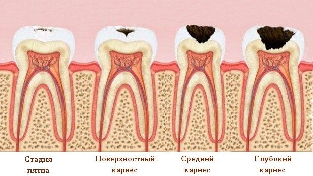 стадии