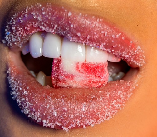 Почему образуется зубной камень? Причины появления и последствия