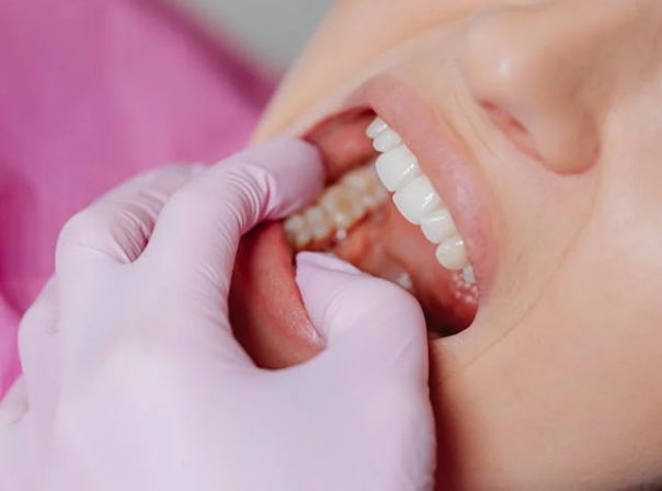 Чем отличается пародонтоз от пародонтита?