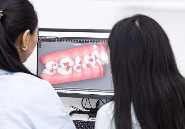 Как убрать налет на зубах?