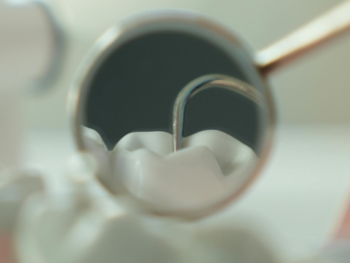 Какой срок службы имплантов зубов?