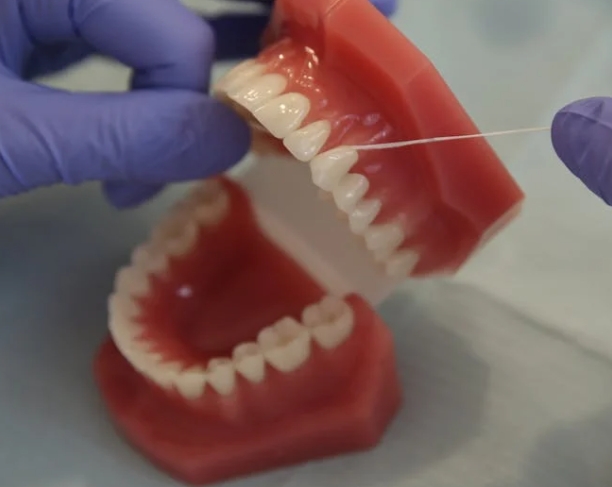 Почему зубы желтеют и как этого избежать?